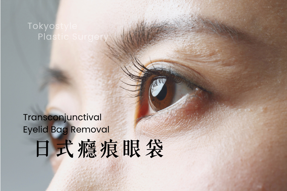 Transconjunctival Eyelid Bag Removal