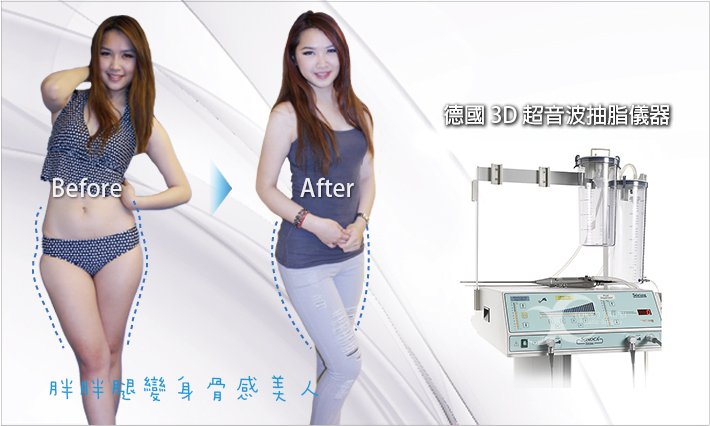 德國3D超音波抽脂儀