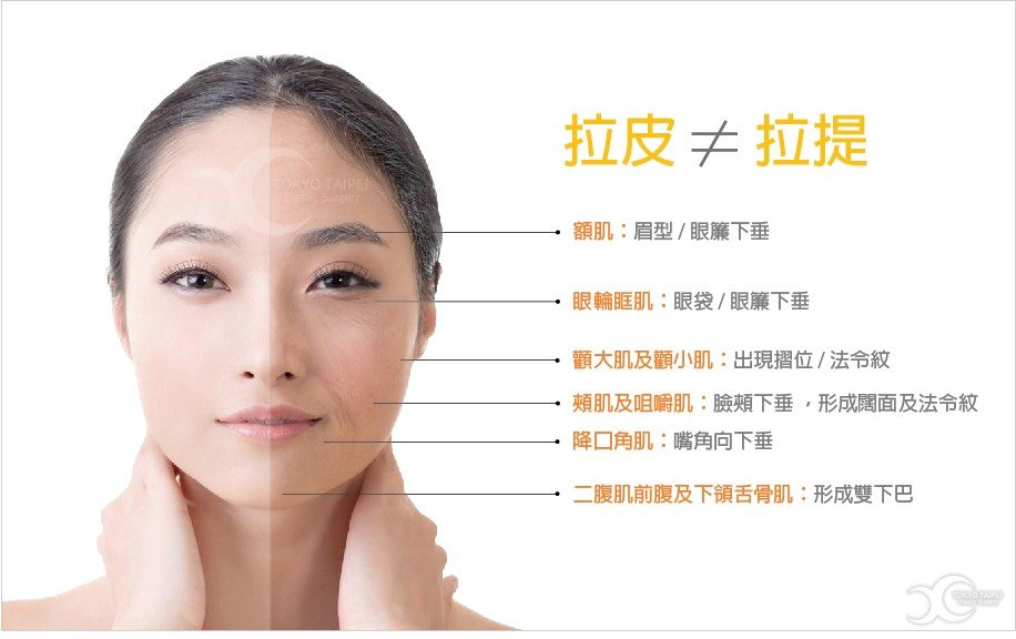 拉皮應用部位