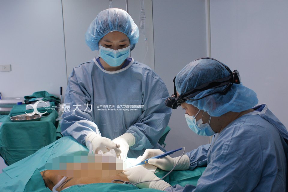 日式乳頭凹陷矯正術