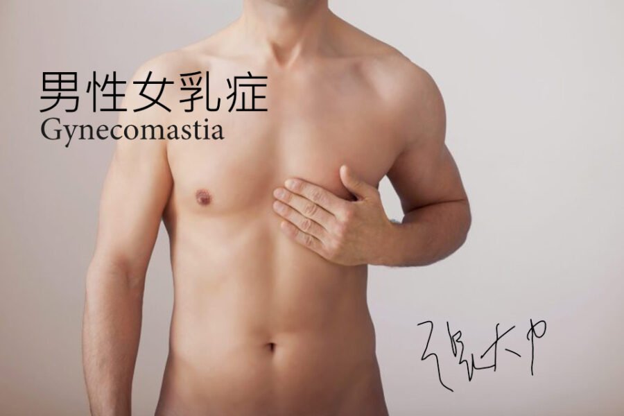 男性女乳症