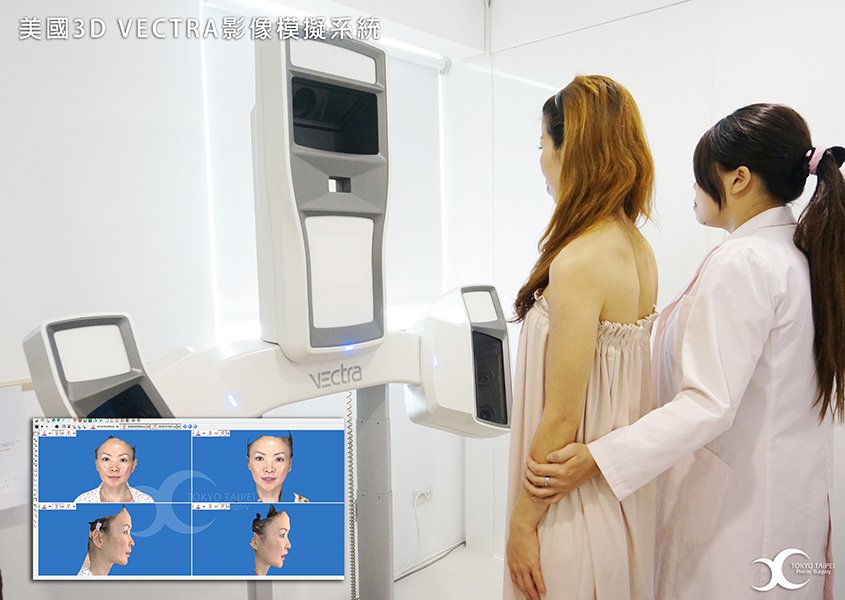 美國3D VECTRA影像模擬系統