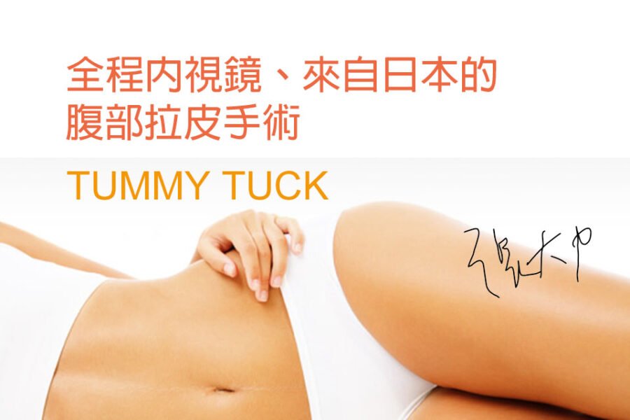 腹部拉皮手術介紹