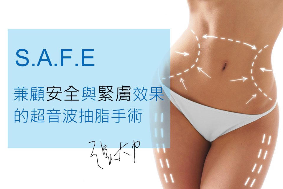 超音波抽脂手術