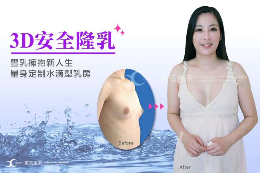 3D隆乳量身定制~ 豐乳擁抱新人生~