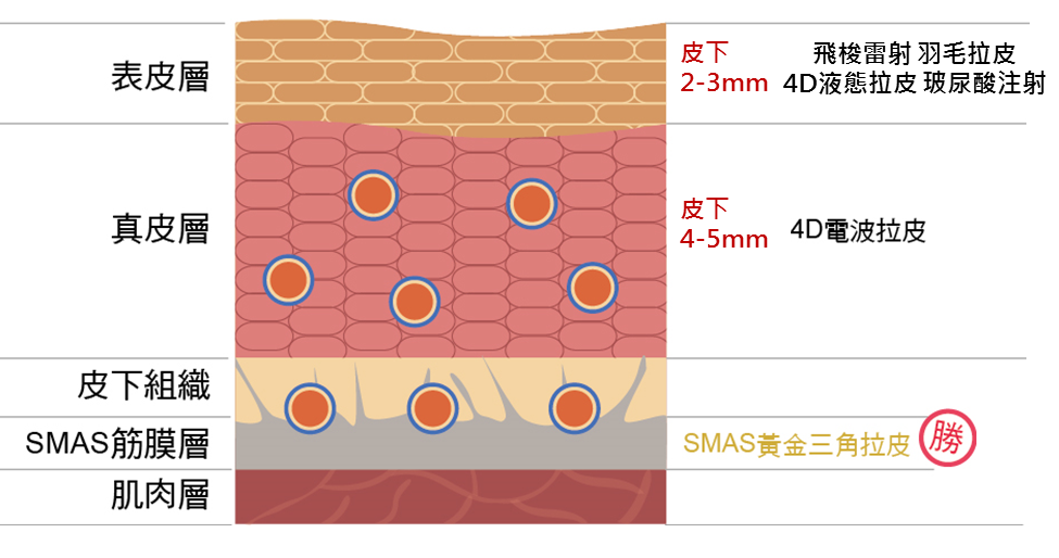 SMAS筋膜拉皮是什麼？從深層改善臉部鬆弛的方法