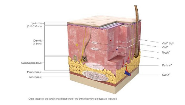 玻尿酸微整形介紹