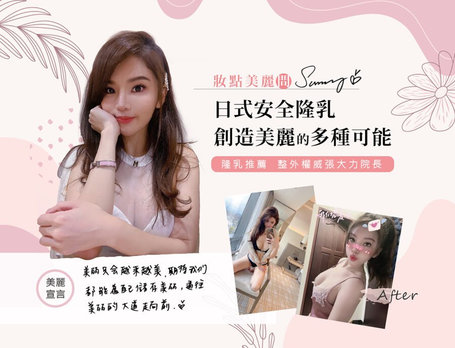 美胸博主Sunny！日式隆乳推薦隆乳權威張大力院長