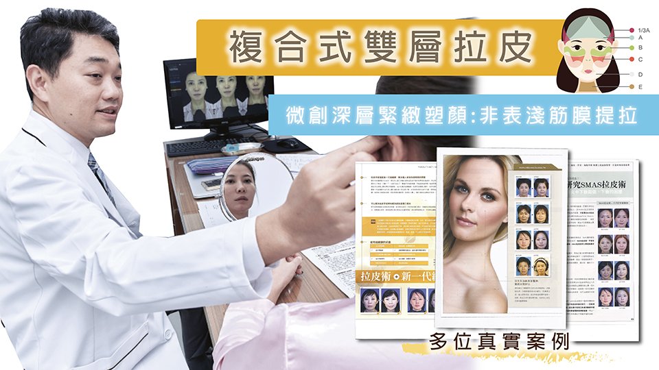 複合式雙層拉皮 讓妳臉部拉皮一次到位