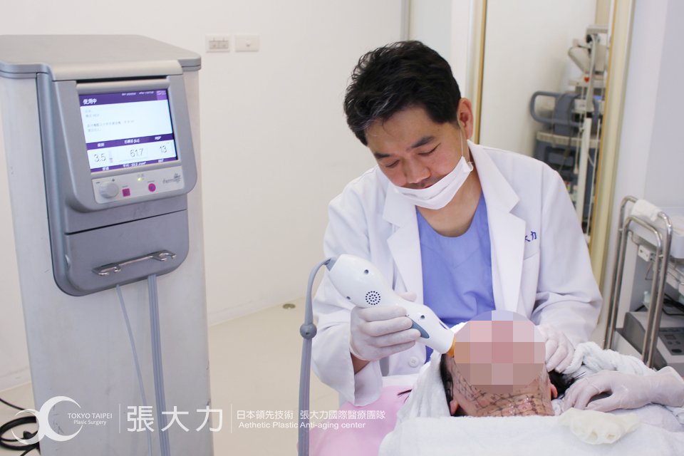 鳳凰電波拉皮 Q&A